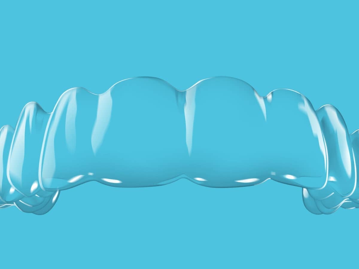 Spark Clear Aligners in New Paltz & Kerhonkson, NY - Dr. Pink Orthodontics