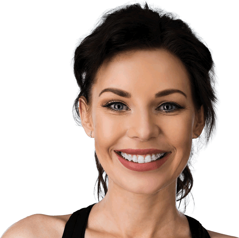 Woman smiling with ceramic braces